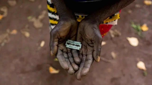 FGM